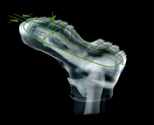 Triple-shock-absorption